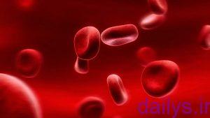 5a24f1c1b521a darman ghelzatkhon irnab ir درمان غلظت خون