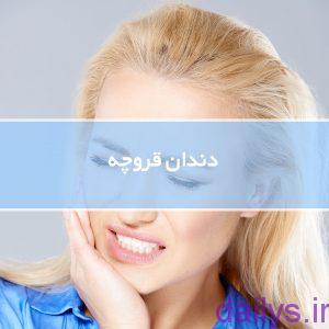 درمان دندان قروچه darmandandan ghoroche irnab ir درمان دندان قروچه